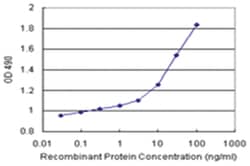 anti-SAE1 Matched Antibody Pair, Ab-2, Abnova