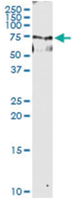 ABCF2, Human, IP-WB Antibody Pair (PW1), Abnova 1 Set:Antibodies, Monoclonal/Polyclonal