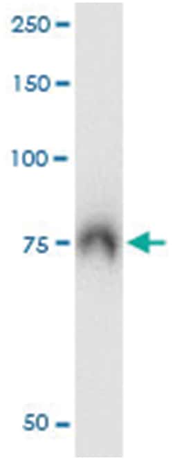 ABCF2, Human, IP-WB Antibody Pair (PW2), Abnova 1 Set | Buy Online | Abnova | Fisher Scientific