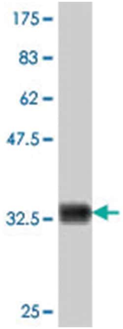 COX17, Mouse, Polyclonal Antibody, Abnova 50 &mu;L | Buy Online | Abnova | Fisher Scientific