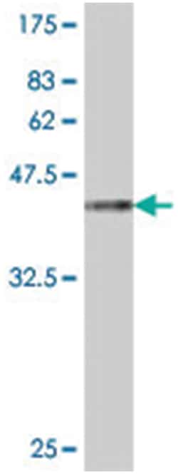 SCAMP3, Mouse, Polyclonal Antibody, Abnova 50 &mu;L | Buy Online | Abnova Corporation | Fisher Scientific