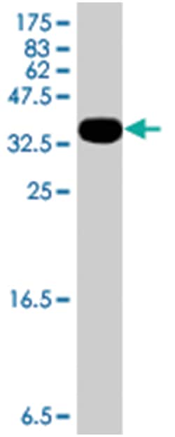 HUWE1, Mouse, Polyclonal Antibody, Abnova 50 &mu;L | Buy Online | Abnova | Fisher Scientific