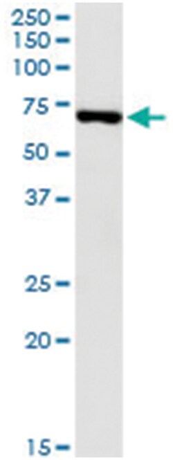anti-USH1C, Human, IP-WB Antibody Pair, Abnova&trade;