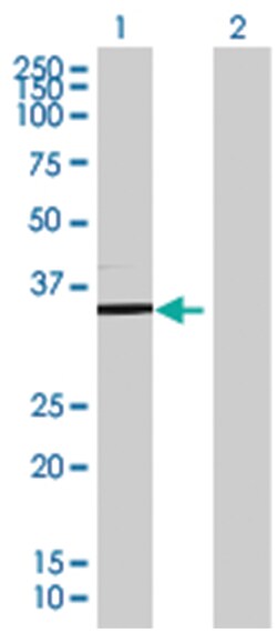 TSFM 293T Cell Overexpression Lysate (Denatured), Abnova 100 &mu;L | Buy Online | Abnova | Fisher Scientific