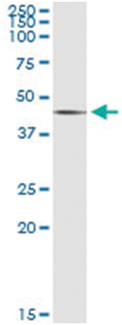 SGK2, Human, IP-WB Antibody Pair (PW2), Abnova&trade;