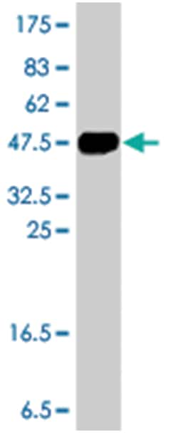 ZNF263, Mouse, Polyclonal Antibody, Abnova 50&mu;L; Unlabeled:Antibodies,