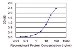 anti-ZNF263, Human, Matched Antibody Pair, Abnova&trade;