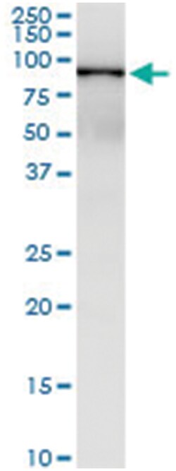 anti-OPTN, Human, IP-WB Antibody Pair, Abnova&trade;