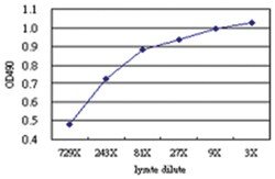 anti-BCAP31 Matched Antibody Pair, Abnova 1 Set, Unlabeled:Antibodies,