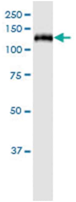 anti-SFRS14, Human, IP-WB Antibody Pair, Abnova 1 Set:Antibodies, Monoclonal/Polyclonal