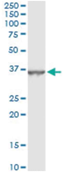 DHRS9, Human, IP-WB Antibody Pair (PW2), Abnova&trade;