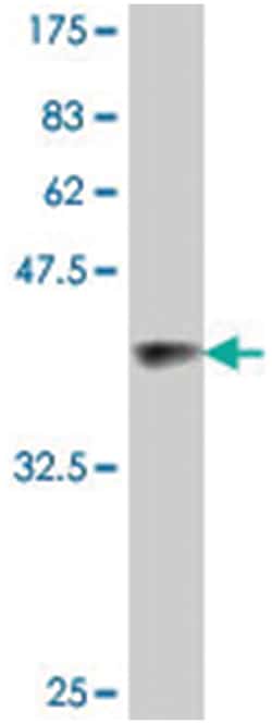 ODZ1, Mouse, Polyclonal Antibody, Abnova 50&mu;L; Unlabeled:Antibodies,
