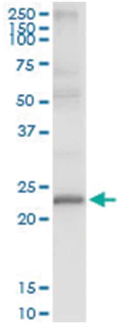 anti-TXNDC9, Human, IP-WB Antibody Pair, Abnova&trade;