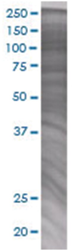 NME6 293T Cell Overexpression Lysate 2 (Denatured), Abnova