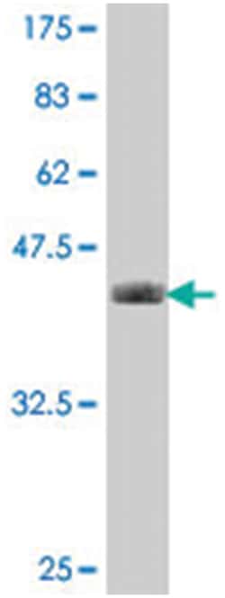 USPL1 (C13orf22), Mouse, Polyclonal Antibody, Abnova™