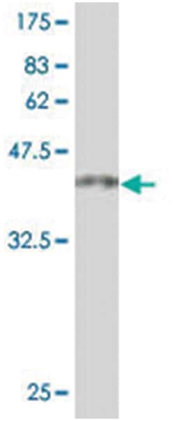 TOPORS, Mouse, Polyclonal Antibody, Abnova 50&mu;L; Unlabeled:Antibodies,