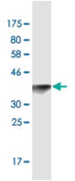 TOPORS, Mouse, Clone: 6D2, Abnova 200&mu;L; Unlabeled:Antibodies, Monoclonal