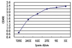 Abnova anti-OLIG2 Matched Antibody Pair, Abnova™