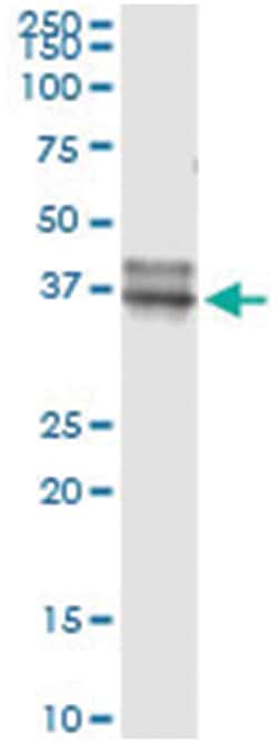 OLIG2, Human, IP-WB Antibody Pair (PW4), Abnova™