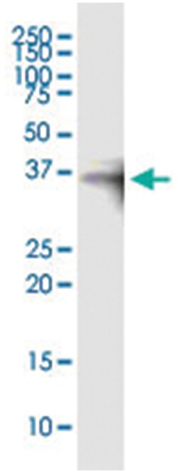 OLIG2, Human, IP-WB Antibody Pair (PW5), Abnova&trade;