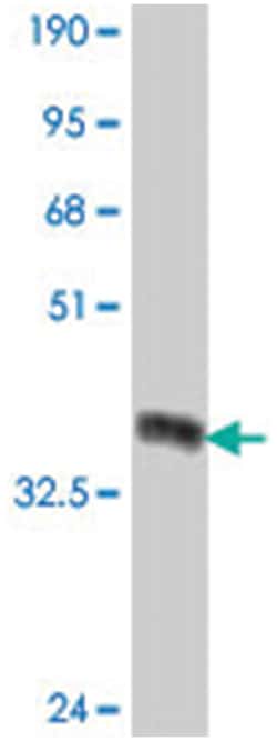 growth differentiation factor 11, Mouse, Polyclonal Antibody, Abnova 50&mu;L;