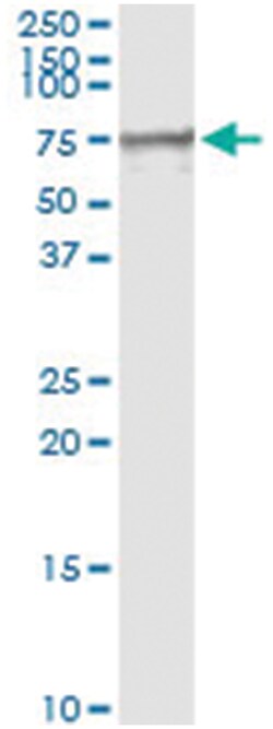 MSLN, Human, IP-WB Antibody Pair (PW1), Abnova&trade;