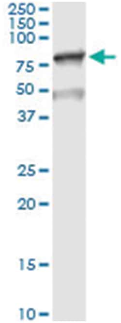 MSLN, Human, IP-WB Antibody Pair (PW2), Abnova&trade;