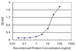 anti-CALCOCO2 Matched Antibody Pair, Abnova