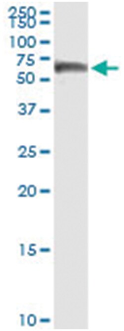 anti-CALCOCO2, Human, IP-WB Antibody Pair, Abnova&trade;