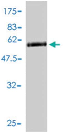 SPRY2, Mouse, Polyclonal Antibody, Abnova™