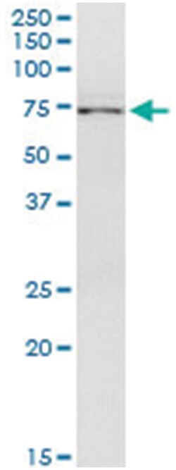 anti-STAM2, Human, IP-WB Antibody Pair, Abnova&trade;