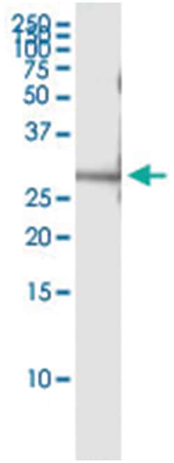 anti-IGSF6, Human, IP-WB Antibody Pair, Abnova 1 Set:Antibodies, Monoclonal/Polyclonal