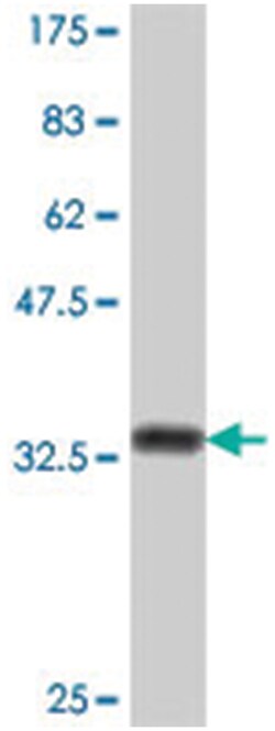IRX5, Mouse, Polyclonal Antibody, Abnova 50&mu;L; Unlabeled:Antibodies,