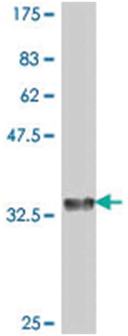 RAMP1, Mouse, Polyclonal Antibody, Abnova 50 &mu;L | Buy Online | Abnova Corporation | Fisher Scientific