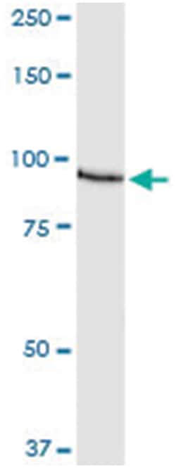 AKAP8, Human, IP-WB Antibody Pair (PW1), Abnova™