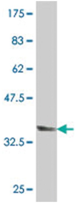 SF3A1, Mouse, Polyclonal Antibody, Abnova 50 &mu;L | Buy Online | Abnova Corporation | Fisher Scientific