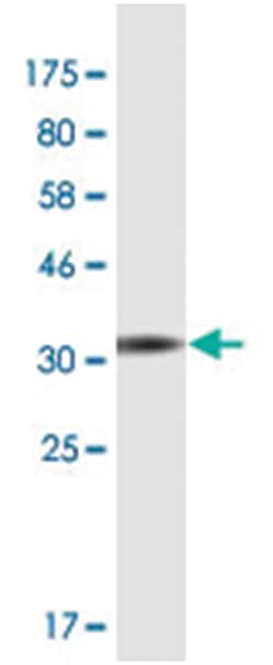 TCIRG1, Mouse, Clone: 7H20, Abnova 200&mu;L; Unlabeled:Antibodies, Monoclonal