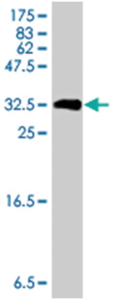 neuromedin U receptor 1, Mouse, Polyclonal Antibody, Abnova 50&mu;L; Unlabeled:Antibodies,