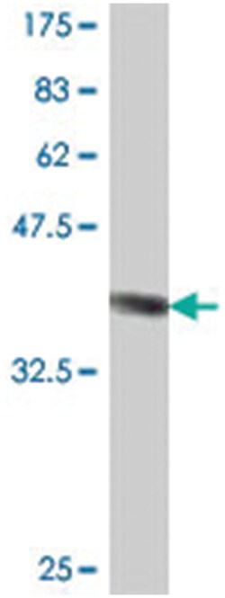 B3GALT5, Mouse, Polyclonal Antibody, Abnova 50&mu;L; Unlabeled:Antibodies,