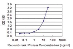 anti-AKR1A1, Human, Matched Antibody Pair, Abnova 1 Set:Antibodies, Monoclonal/Polyclonal
