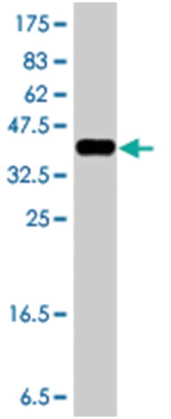 TFG, Mouse, Polyclonal Antibody, Abnova 50&mu;L; Unlabeled:Antibodies,