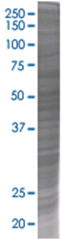 TFG 293T Cell Overexpression Lysate (Denatured), Abnova 100 &mu;L | Buy Online | Abnova | Fisher Scientific