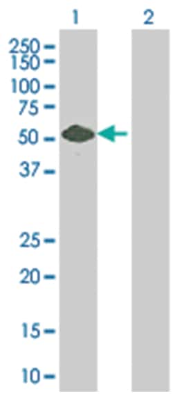 TFG 293T Cell Overexpression Lysate (Denatured), Abnova 100 &mu;L | Buy Online | Abnova | Fisher Scientific