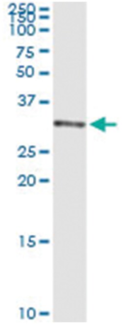 anti-WARS2, Human, IP-WB Antibody Pair, Abnova&trade;