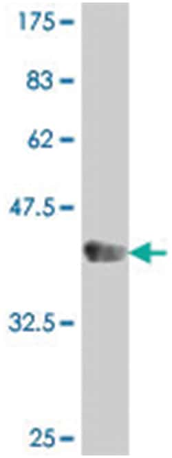 SEMA3A, Mouse, Polyclonal Antibody, Abnova™