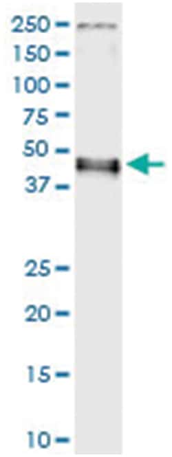 anti-IRF9, Human, IP-WB Antibody Pair, Abnova&trade;