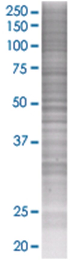BPNT1 293T Cell Overexpression Lysate (Denatured), Abnova 100 &mu;L | Buy Online | Abnova | Fisher Scientific