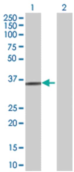 BPNT1 293T Cell Overexpression Lysate (Denatured), Abnova 100 &mu;L | Buy Online | Abnova | Fisher Scientific