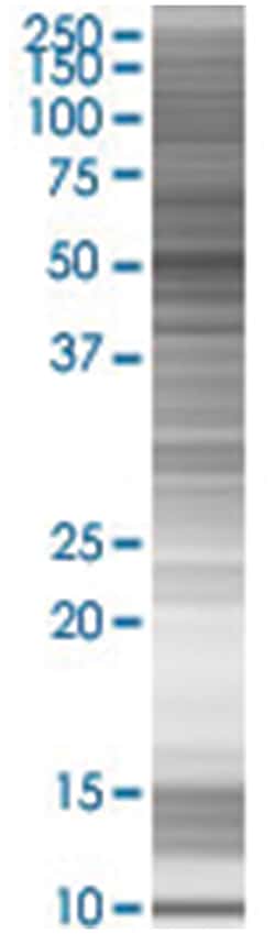 CORO2B 293T Cell Overexpression Lysate (Denatured), Abnova 100 &mu;L | Buy Online | Abnova | Fisher Scientific