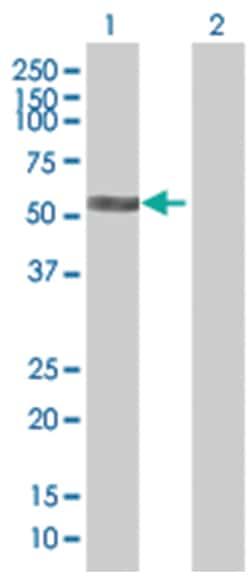 CORO2B 293T Cell Overexpression Lysate (Denatured), Abnova 100 &mu;L | Buy Online | Abnova | Fisher Scientific